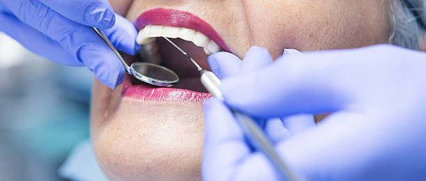 Best Knocked-Out Tooth Emergency  in Paddock Lake, WI